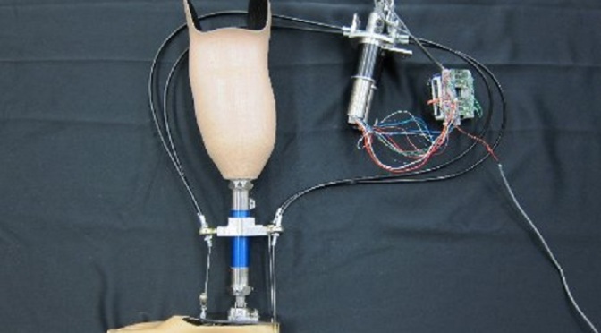 From Michigan Tech, An Artificial Leg That Keeps An Eye On The Road